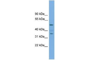 WB Suggested Anti-Nobox Antibody Titration: 0. (NOBOX anticorps  (Middle Region))
