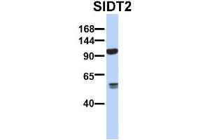 Host:  Rabbit  Target Name:  SERPINA3  Sample Type:  Human Adult Placenta  Antibody Dilution:  1. (SIDT2 anticorps  (N-Term))