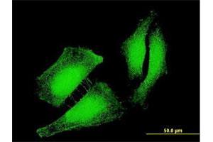 Immunofluorescence of monoclonal antibody to FOXO3 on HeLa cell. (FOXO3 anticorps  (AA 361-460))