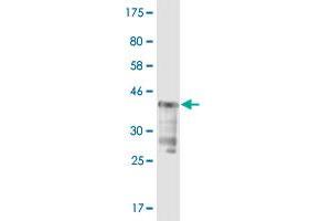 Western Blot detection against Immunogen (37. (USP5 anticorps  (AA 71-180))