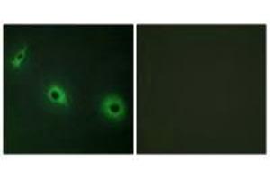 Immunofluorescence analysis of HepG2 cells, using CELSR3 antibody. (CELSR3 anticorps)