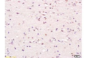 Formalin-fixed and paraffin embedded mouse heart labeled with Anti phospho-PI3K p85/PIK3R1(Tyr368) Polyclonal Antibody, Unconjugated (ABIN711041) at 1:200 followed by conjugation to the secondary antibody and DAB staining (PIK3R1 anticorps  (pTyr368))