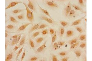 Immunocytochemistry analysis of Hela cells using ABIN7139597 at dilution of 1:100