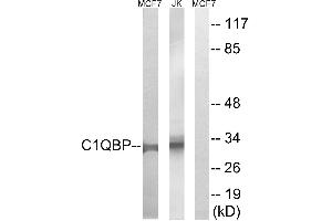 Immunohistochemistry analysis of paraffin-embedded human tonsil tissue, using C1QBP antibody. (C1QBP anticorps)