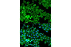 Immunofluorescence analysis of HeLa cell using JUP antibody. (JUP anticorps  (AA 1-300))