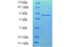 SDS-PAGE (SDS) image for Coiled-Coil-Helix-Coiled-Coil-Helix Domain Containing 4 (CHCHD4) (AA 1-142), (full length) protein (His-SUMO Tag) (ABIN5711676)