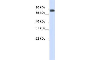WB Suggested Anti-MST1 Antibody Titration:  0. (MST1 anticorps  (Middle Region))