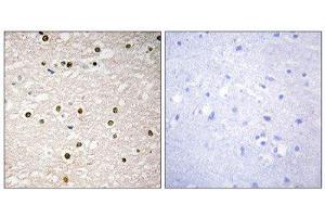 Immunohistochemistry (IHC) image for anti-Tumor Protein P73 (TP73) (Internal Region) antibody (ABIN1848960)