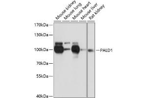 Western blot analysis of extracts of various cell lines, using P antibody (ABIN6133270, ABIN6145194, ABIN6145195 and ABIN6216692) at 1:3000 dilution. (KIAA1274 anticorps  (AA 1-300))