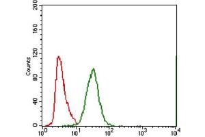 Immunohistochemical analysis of paraffin-embedded bladder cancer tissues using ABCC4 antibody with DAB staining.