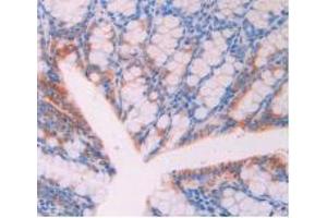 Figure. (CD47 anticorps  (AA 18-219))