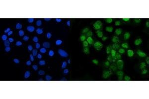 IF analysis of LSM8 using anti-LSM8 antibody (ABIN7599579). (NAA38 anticorps  (AA 1-96))
