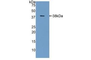 Western blot analysis of recombinant Human GAL8. (LGALS8 anticorps  (AA 1-317))