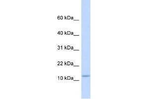 WB Suggested Anti-C9orf46 Antibody Titration:  0.