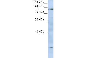 WB Suggested Anti-FMNL2 Antibody Titration:  0. (FMNL2 anticorps  (N-Term))