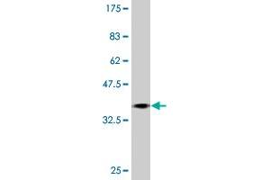 Western Blot detection against Immunogen (37.