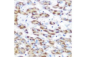 Immunohistochemistry of paraffin-embedded human liver using Presenilin 1 Rabbit pAb (ABIN3023159, ABIN3023160, ABIN3023161 and ABIN6219418) at dilution of 1:100 (40x lens). (Presenilin 1 anticorps  (AA 1-160))