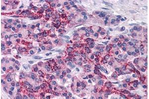 Human Pancreas: Formalin-Fixed, Paraffin-Embedded (FFPE) (XIAP anticorps  (AA 75-226))
