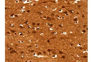 The image on the left is immunohistochemistry of paraffin-embedded Human brain tissue using ABIN7190038(CACNA1E Antibody) at dilution 1/15, on the right is treated with synthetic peptide. (CACNA1E anticorps)
