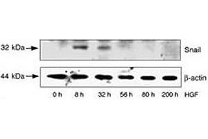 HepG2 cells were incubated with HGF for the indicated time periods. (SNAIL anticorps  (AA 9-39))