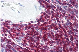 Human Spleen (formalin-fixed, paraffin-embedded) stained with CD6 antibody ABIN294221 at 10 ug/ml followed by biotinylated anti-mouse IgG secondary antibody ABIN481714, alkaline phosphatase-streptavidin and chromogen. (CD6 anticorps)