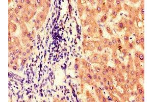 Immunohistochemistry of paraffin-embedded human liver tissue using ABIN7145231 at dilution of 1:100