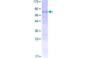 Image no. 1 for Ring Finger Protein 215 (RNF215) (AA 1-377) protein (GST tag) (ABIN1318348)