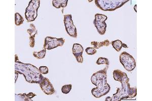 IHC analysis of ATP5F1B using anti-ATP5F1B antibody (ABIN7599866). (Atp5f1b (AA 123-529) anticorps)