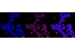Immunocytochemical staining of Hela cells with PDX1 antibody (ABIN7799731), 1:1,000).