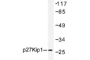 Image no. 1 for anti-Cyclin-Dependent Kinase Inhibitor 1B (p27, Kip1) (CDKN1B) antibody (ABIN271763) (CDKN1B anticorps)