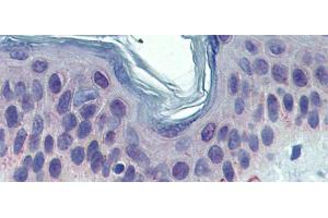 Rabbit Anti-TYRP1 Antibody  arp44315 Paraffin Embedded Tissue: Human Skin Antibody Concentration: 5 ug/ml