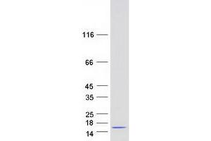 Validation with Western Blot
