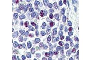 IHC analysis of FFPE human spleen tissue stained with KLF4 antibody