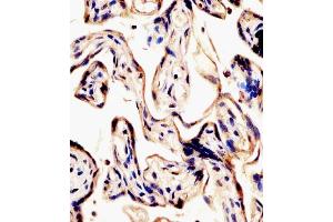 (ABIN6242136 and ABIN6578441) staining ERVK-7 in human placenta tissue sections by Immunohistochemistry (IHC-P - paraformaldehyde-fixed, paraffin-embedded sections). (ERVK-7 anticorps  (AA 96-128))