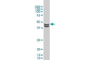 CSNK2A1 monoclonal antibody (M01), clone 3D9 Western Blot analysis of CSNK2A1 expression in Hela S3 NE .
