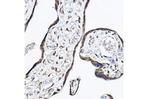 Immunohistochemistry of paraffin-embedded human placenta using P Rabbit pAb (ABIN6130631, ABIN6145213, ABIN6145214 and ABIN6214119) at dilution of 1:50 (40x lens). (PAP Associated Domain Containing 7 (PAPD7) (AA 303-542) anticorps)