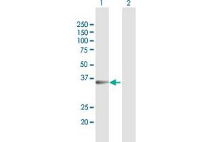 Western Blot analysis of SULT1B1 expression in transfected 293T cell line by SULT1B1 MaxPab polyclonal antibody.