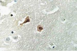 Immunohistochemistry (IHC) analyzes of VCP antibody in paraffin-embedded human brain tissue. (VCP anticorps)