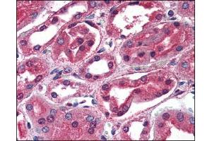 Image no. 1 for anti-Sodium Channel, Nonvoltage-Gated 1, gamma (SCNN1G) (C-Term) antibody (ABIN372870)