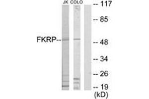 Western blot analysis of extracts from Jurkat/COLO205 cells, using FKRP Antibody. (FKRP anticorps  (AA 1-50))