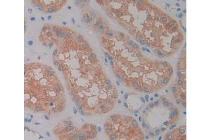 Used in DAB staining on fromalin fixed paraffin- embedded kidney tissue