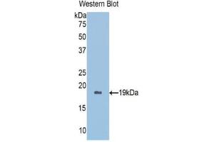 Western blot analysis of the recombinant protein. (Peroxiredoxin 5 anticorps  (AA 1-162))