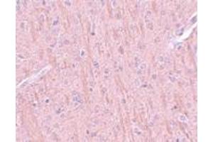 Immunohistochemistry (IHC) image for anti-Coiled-Coil Domain Containing 106 (CCDC106) (C-Term) antibody (ABIN1030324) (CCDC106 anticorps  (C-Term))