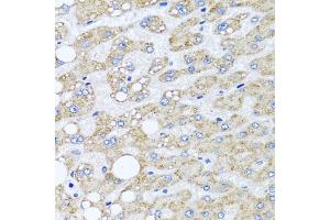 Immunohistochemistry of paraffin-embedded human liver damage using SRI antibody  at dilution of 1:100 (40x lens).