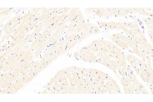 anti-Lipoprotein (Lp(a)) (AA 1719-2038) antibody