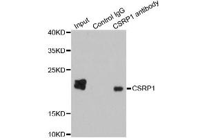 Immunoprecipitation analysis of 200ug extracts of HepG2 cells using 1ug CSRP1 antibody. (CSRP1 anticorps)