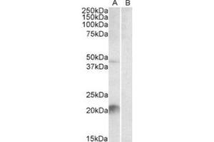 Western Blotting (WB) image for anti-Kallikrein 6 (KLK6) (C-Term) antibody (ABIN2464235) (Kallikrein 6 anticorps  (C-Term))