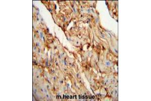 MYOZ1 Antibody immunohistochemistry analysis in formalin fixed and paraffin embedded mouse heart tissue followed by peroxidase conjugation of the secondary antibody and DAB staining.