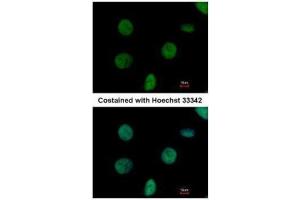 ICC/IF Image Immunofluorescence analysis of paraformaldehyde-fixed HeLa, using C1orf57, antibody at 1:500 dilution. (C1orf57 anticorps  (C-Term))