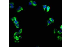 Immunofluorescence staining of PC-3 cells with ABIN7158533 at 1:166, counter-stained with DAPI.